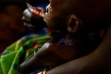 Těžce podvyživených a v ohrožení života je podle šéfa Dětského fondu OSN Jeremyho Hopkinse i přes 250 tisíc dětí.