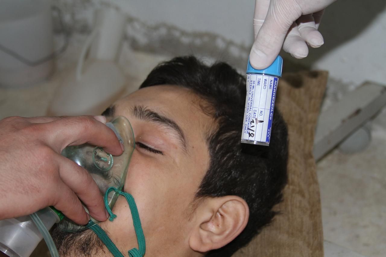 Jedna z obětí možného chemického útoku v Damašku