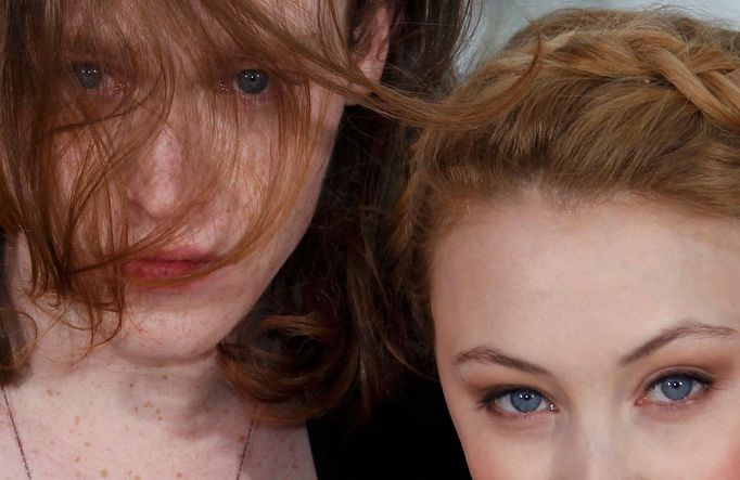 Sarah Gadon a Caleb Landry Jones hrají v thrilleru Antiviral Brandona Cronenberga