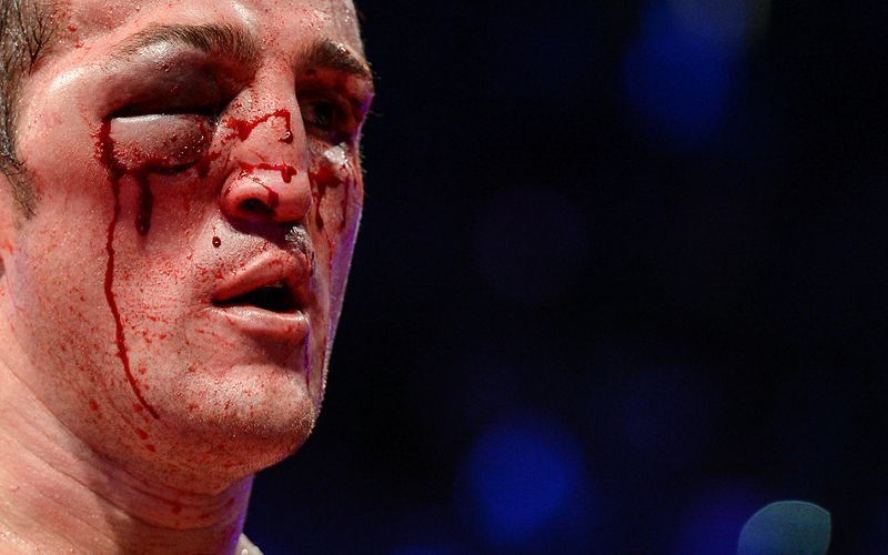 Totálně rozbitý Denis Lebeděv po zápase s Guillermem Jonesem