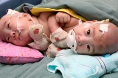 Čínské úřady donutily k potratu ženu v 9. měsíci