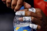 "Fedexovi" nepomohlo ani zranění Nadala, kterého trápil puchýř na levé ruce.