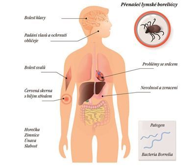 joalis foto v clanku1