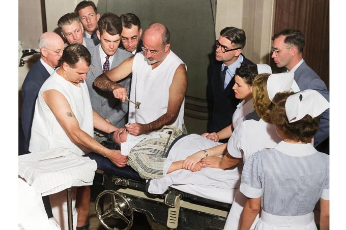 Dr. Walter Freeman provádí lobotomii pomocí nástroje podobného cepínu, který zavedl pod oční víčko pacienta, aby přerušil nervová spojení v mozku, 1949. Kolorováno.