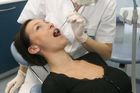 Soumrak vrtání? Vědci testují gel, co sám spravuje zuby