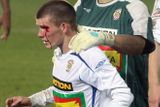 V utkání se krvavě zranil Milan Lutonský...