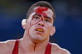 Zkrvavená tvář venezuelského zápasníka Ricarda Robertyho Morena během jeho souboje s Augustem Midanem z Guineje.