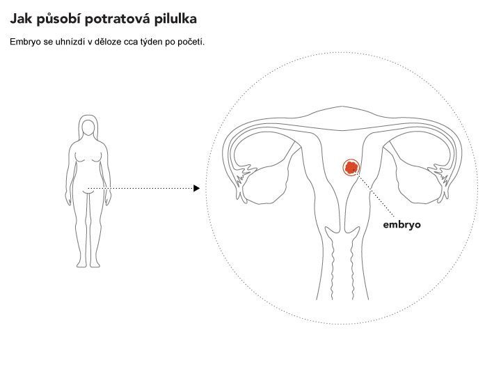 RU 486 potratová pilulka