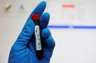 WADA získala data z ruské antidopingové laboratoře