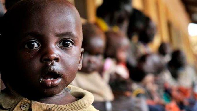 Žalostně nízká podpora rozvinutých zemí stále znemožňuje účinnou a rozsáhlou léčbu dětské podvýživy, která je ročně příčinou úmrtí téměř 5 milionů dětí mladších 5 let.