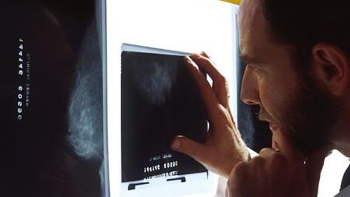 Normální rentgen muži nestačil, proto mu lékaři doporučili přístroj v zoologické zahradě