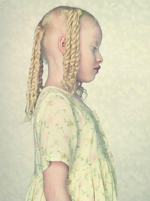 Fotografie albínů od Gustavo Lacerdy
