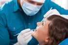 Ministerstvo nabízí přes milion zubařům, kteří si otevřou ordinaci na venkově nebo v malém městě