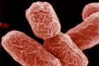Vzorek aquily s E. coli byl předán národní laboratoři