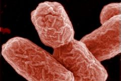 Bakterie jsou supi v nás. Dorazí nás, když jsme slabí, říkají čeští objevitelé nového antibiotika