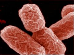 Nový kmen E.coli je mimořádně rezistentní vůči běžným antibiotikům