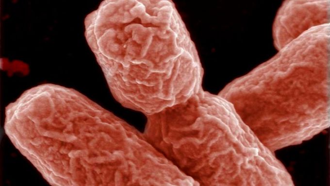 Laboratoř potvrdila, že nalezené bakterie E. coli nejsou patogenní.