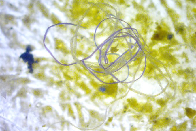 Mikroplasty je obecné označení, užívané pro různorodé úlomky plastů o velikosti od 100 nanometrů až po 5 milimetrů, které se vyskytují ve vodě, v půdě i ve vzduchu.