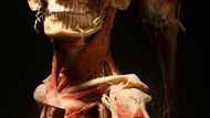 Metodu konzervace lidských těl, pojmenovanou plastinace, vymyslel německý anatom Gunther von Hagens. Vodu a tuk při ní nahrazuje plastická hmota.