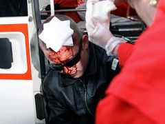7 extremists, 7 police and a journalist injured in Litvínov street fights