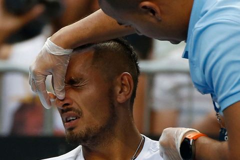 Australian Open, den první (Nick Kyrgios