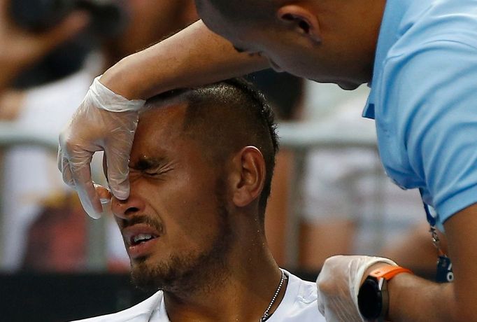 Australian Open, den první (Nick Kyrgios