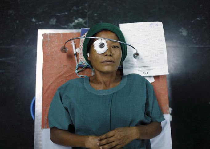 A patient with cataract lies on a hospital bed upon receiving anesthesia during a cataract surgery at the Tilganga Eye Center in Kathmandu April 25, 2012. About 150,000 of Nepal's 26.6 million people are estimated to be blind in both eyes, most of them with cataracts. Picture taken April 25, 2012. REUTERS/Navesh Chitrakar (NEPAL - Tags: HEALTH SOCIETY POVERTY TPX IMAGES OF THE DAY) Published: Kvě. 2, 2012, 4:25 dop.