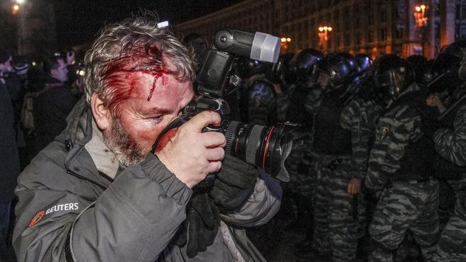 Zraněný Gleb Garanič, fotograf britské tiskové agentury Reuters.