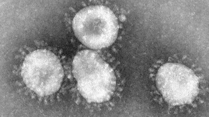 Koronaviry způsobují onemocnění SARS.