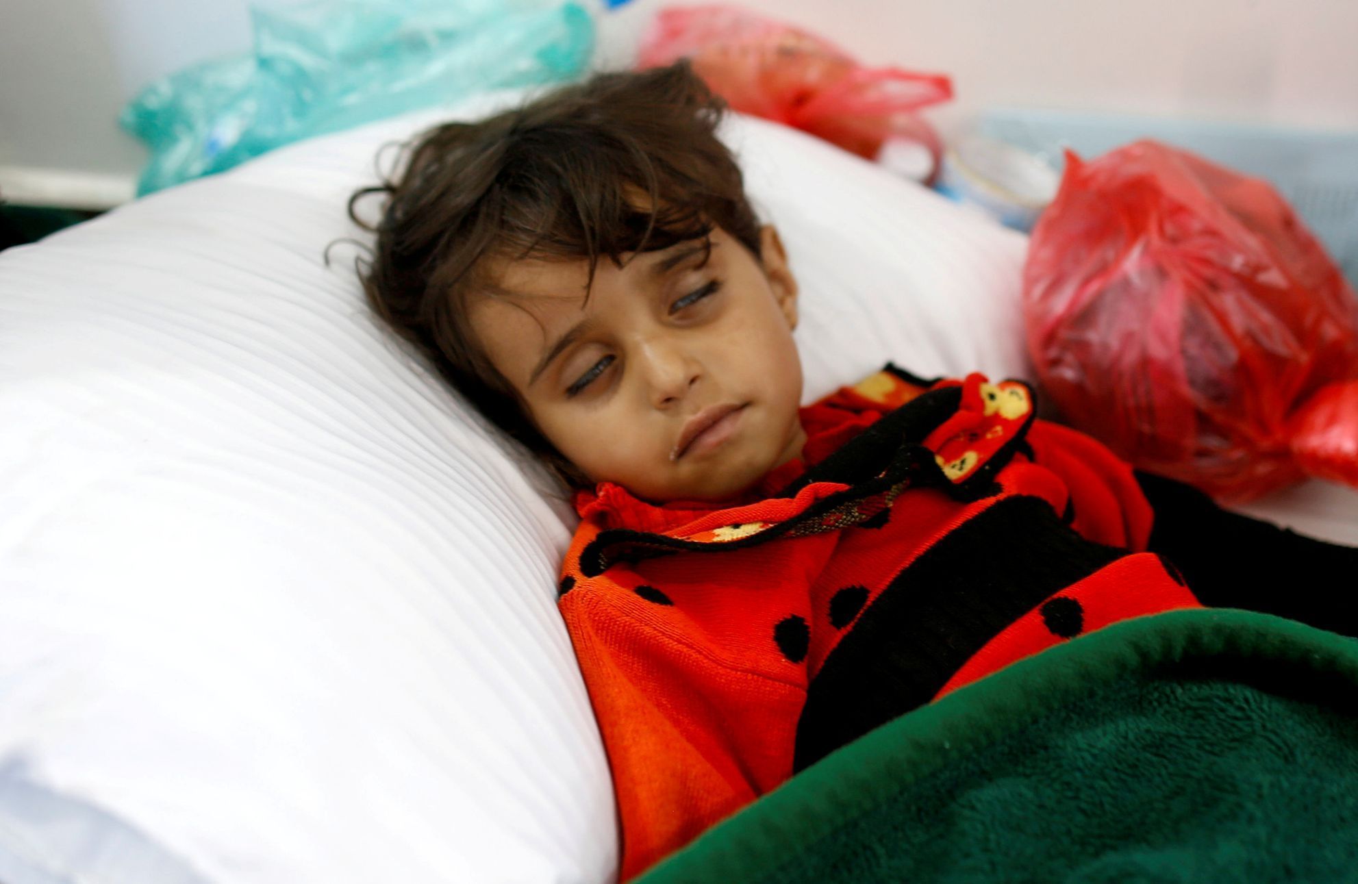 Malá dívka v jemenském Saná nakažená cholerou.