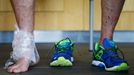 An ice bag is seen on the ankle of Japan's Luke Thompson as he speaks to members of the media after training