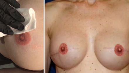 Vytetovat se dá i bradavka. Sebevědomí po rakovině dokáže vrátit i obyčejné tetování