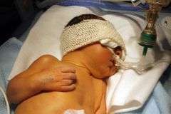 Odchod lékařů omezí péči ve středočeských porodnicích