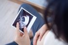Rychlejší řešení neplodnosti. Umělá inteligence pomůže přesněji než lidé, říká lékař