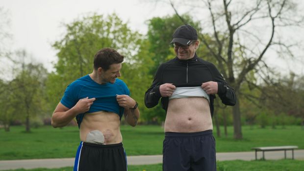 Žijí s pytlíkem na břiše a nepříjemnými pohledy okolí. V Česku je 14 tisíc stomiků