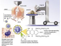 Schéma působení magnetických nanočástic, které k nádoru "navádí" elektromagnet.