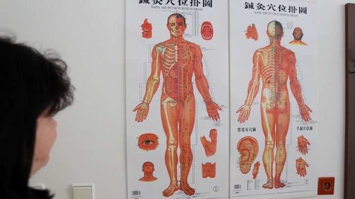 Centrum čínské medicíny v Hradci končí. Vedoucí bude dále provádět akupunkturu