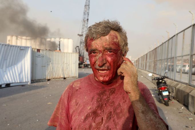 Zraněný muž po výbuchu v Bejrútu.