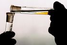 Britský lékař prý poskytoval doping více než 150 sportovcům