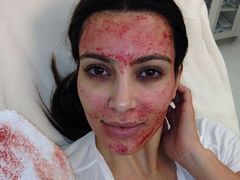 Kim Kardashian se omlazuje vlastní krví