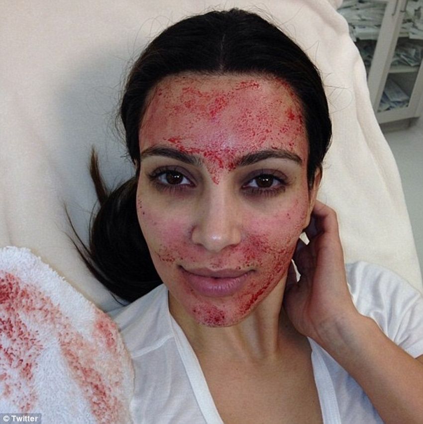 Kim Kardashian na krvavé kosmetice