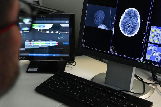 Městská nemocnice Ostrava si díky dotaci pořídila mimo jiné i počítačový tomograf.