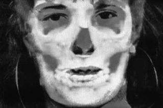 Kriminalistická superprojekce lebky Moniky Ondíkové s její fotografií, srpen 1990. Metoda pomohla potvrdit totožnost oběti nalezené v rozkladu u Konopiště.​​