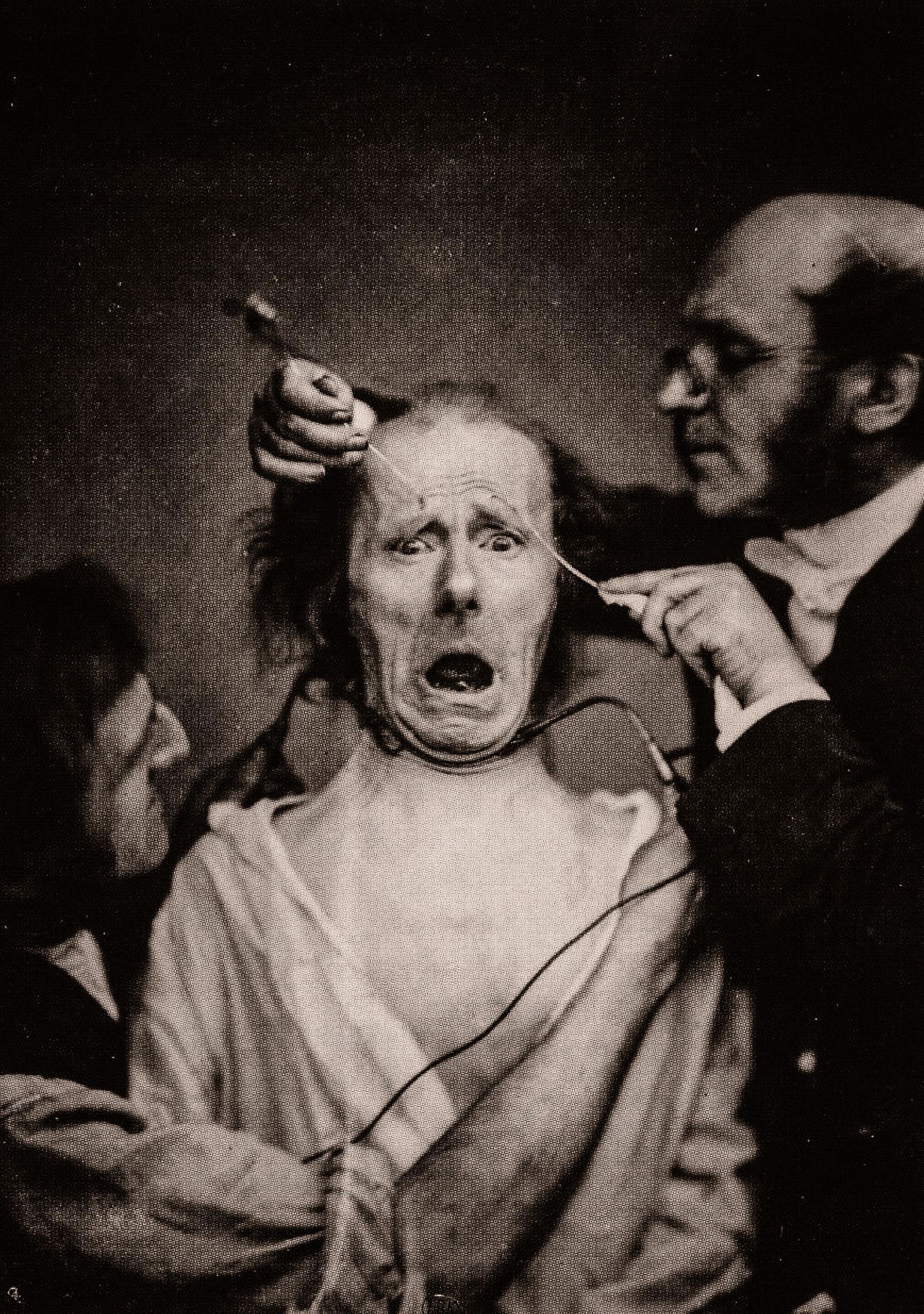 Výrazy ve tvářích po stimulaci elektrodou: Guillaume Benjamin Amand Duchenne de Boulogne a Adrien Tournachon, 1854–56