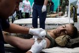Zraněný ruský voják je ošetřován v provizorní nemocnici v osadě Džhava.