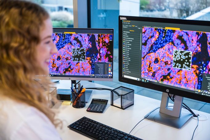 Vědkyně z týmu Sotia analyzuje pomocí digitálního softwaru imunitní buňky v nádorovém mikroprostředí.