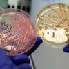 Baktérie E.coli na eppendorfské klinice 2