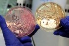 V květáku z Evropy našli v Thajsku bakterii E.coli
