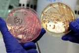 19. 6. - Němci našli smrtící E. coli v potoce ve Frankfurtu. Podrobnosti najdete - zde
