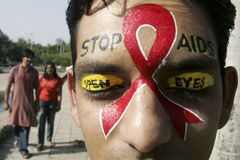 Den boje proti AIDS připomenou fotografie nemocných